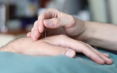 The Roots of Acupuncture and Advantages To Excellent Health and wellness
