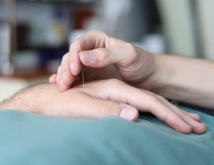 The Roots of Acupuncture and Advantages To Excellent Health and wellness