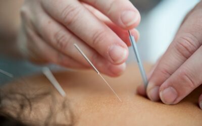 The roots of Acupuncture and Needles
